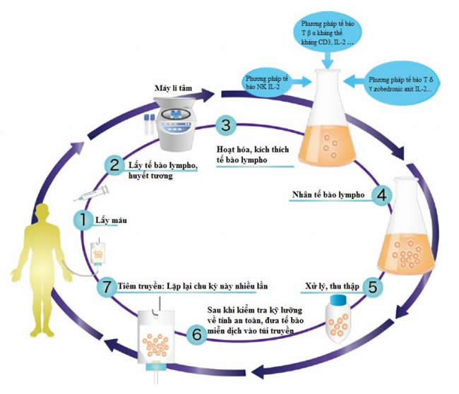 Liệu ph&aacute;p tế b&agrave;o lympho hoạt h&oacute;a tự th&acirc;n