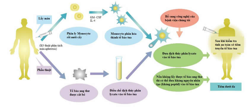 Liệu ph&aacute;p vắc-xin tế b&agrave;o tua (kiểu cảm ứng miễn dịch tế b&agrave;o)