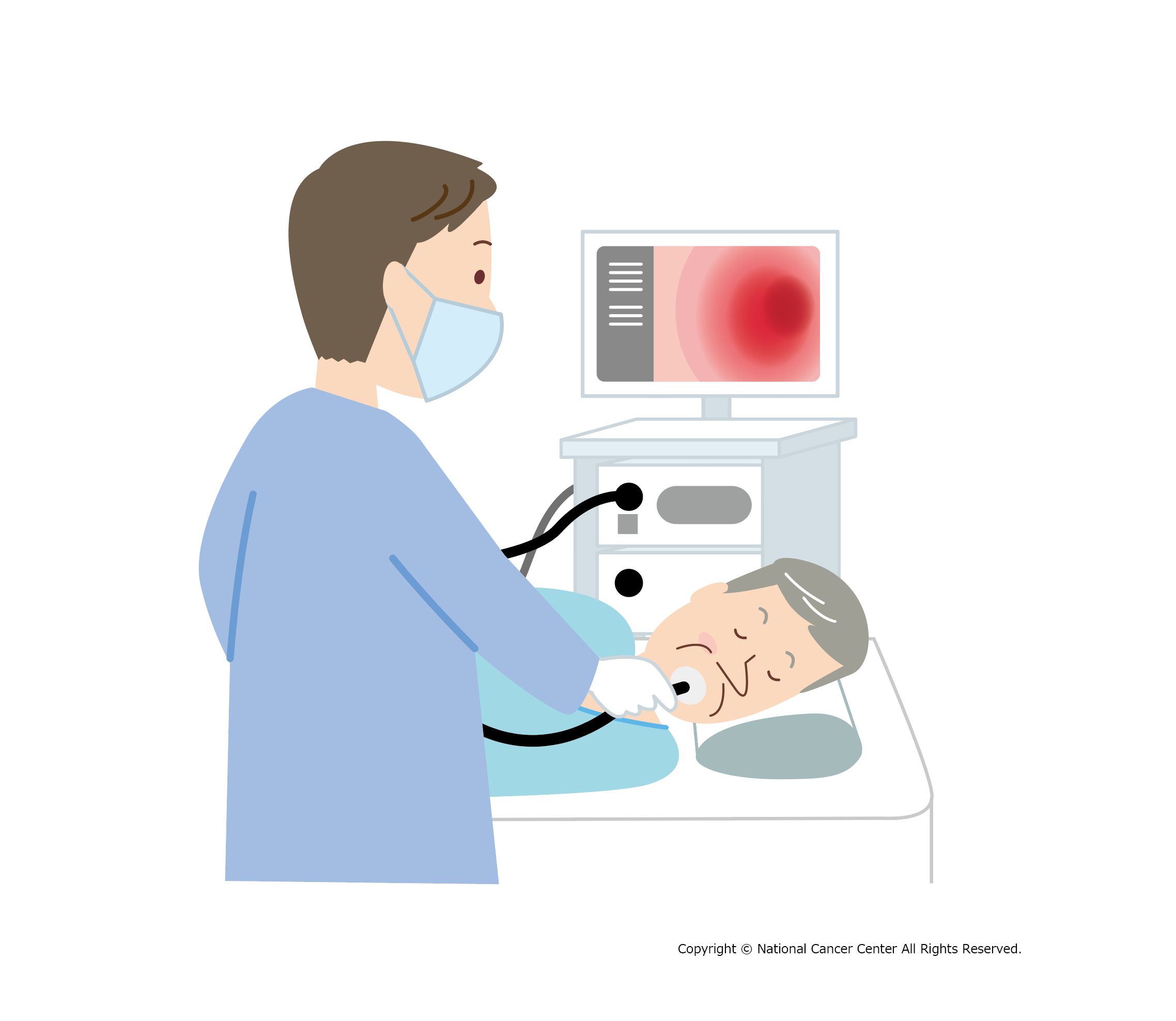 ung-thu-thuc-quan-chan-doan-nguyen-nhan-va-dieu-tri-theo-y-khoa-nhat-ban