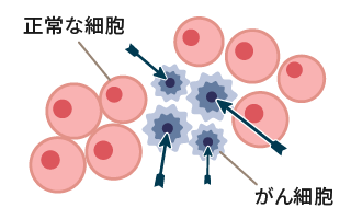 y-hoc-gen-ung-thu-la-gi-ung-dung-y-hoc-chinh-xac-trong-dieu-tri-tai-nhat-ban-vjiic