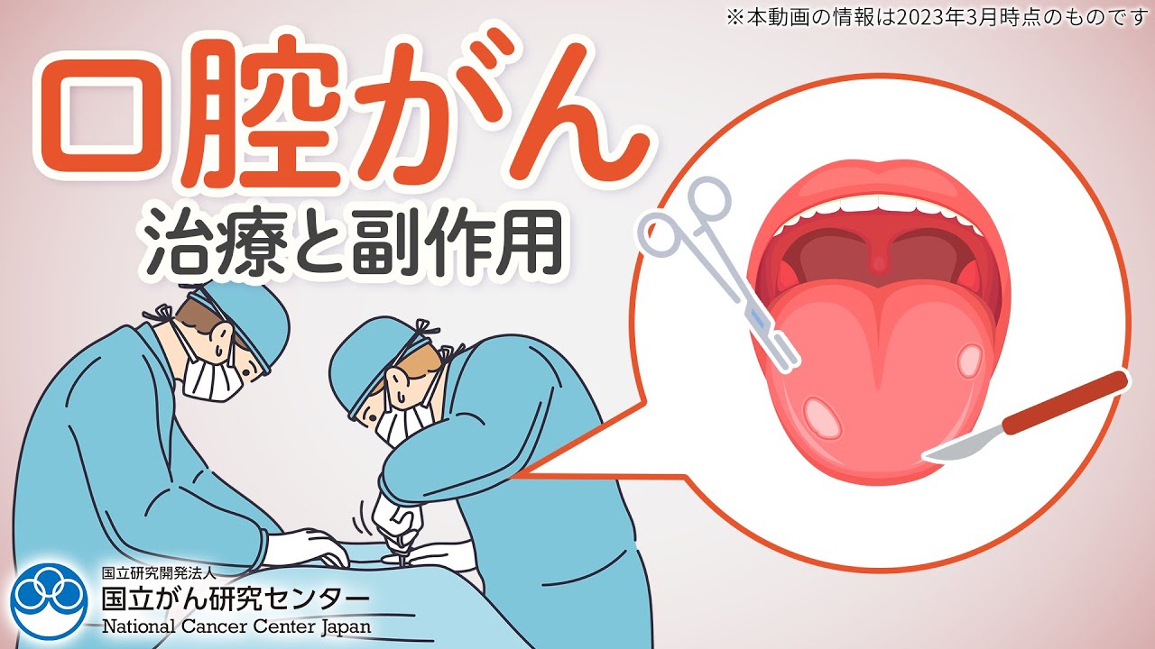 ung-thu-khoang-mieng-dau-hieu-nhan-biet-nguyen-nhan-va-cach-phong-ngua