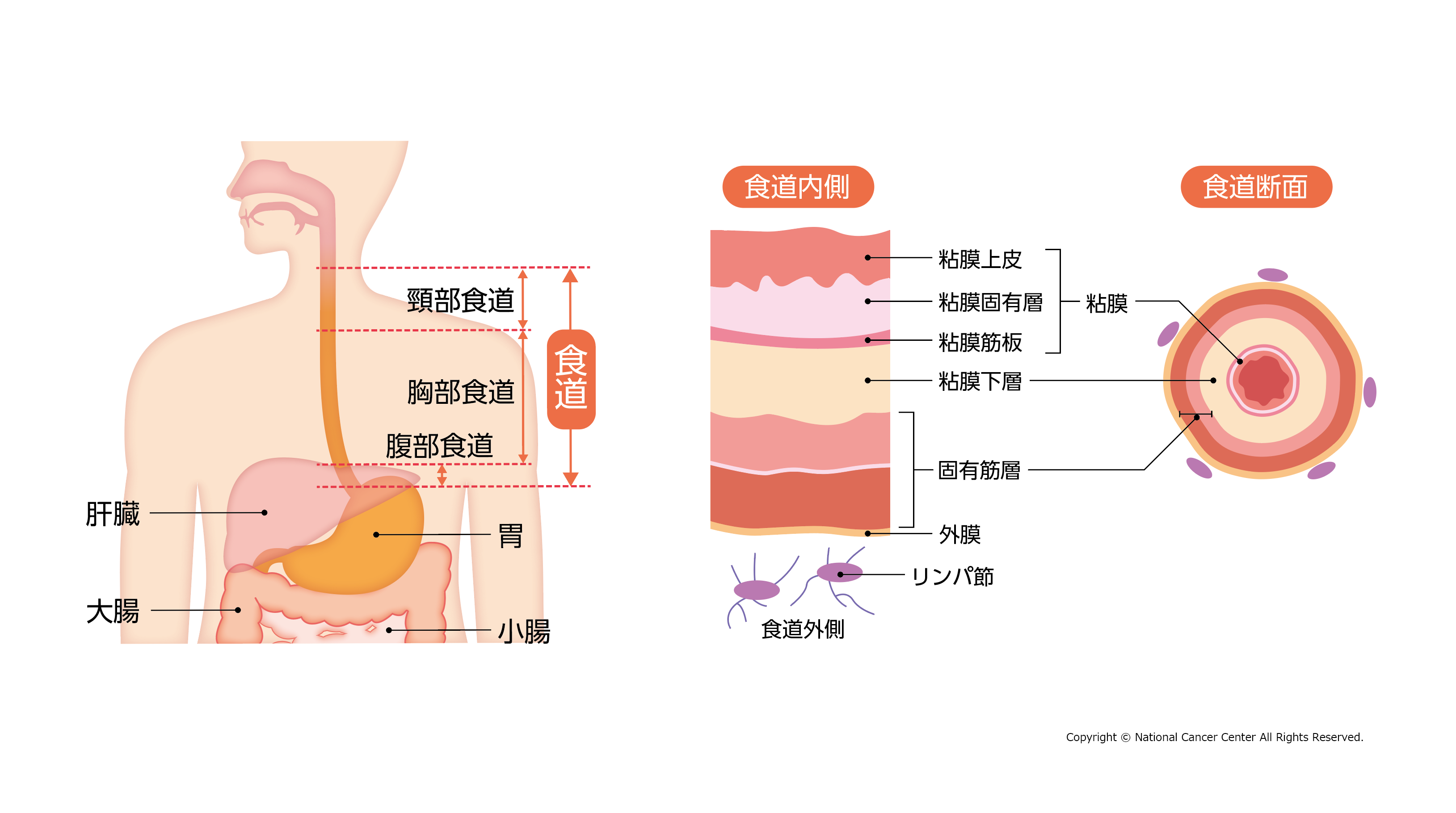 ung-thu-thuc-quan-nguyen-nhan-trieu-chung-chan-doan-va-dieu-tri