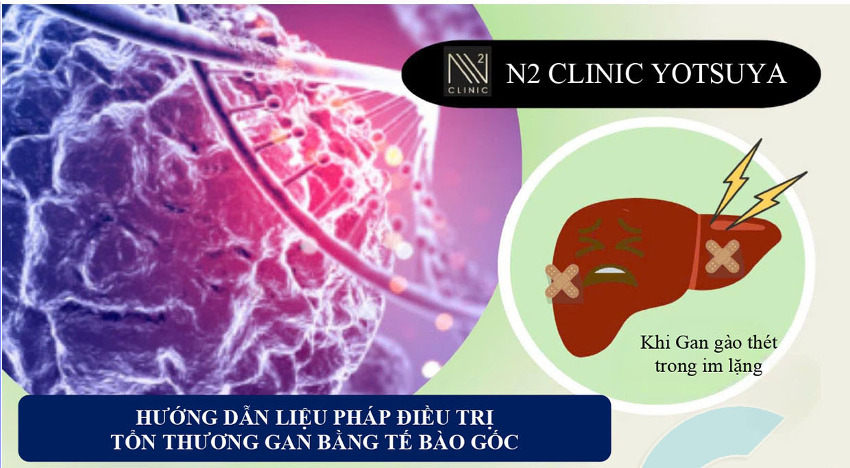 lieu-phap-dieu-tri-ton-thuong-gan-bang-te-bao-goc-tai-n2-clinic-yotsuya