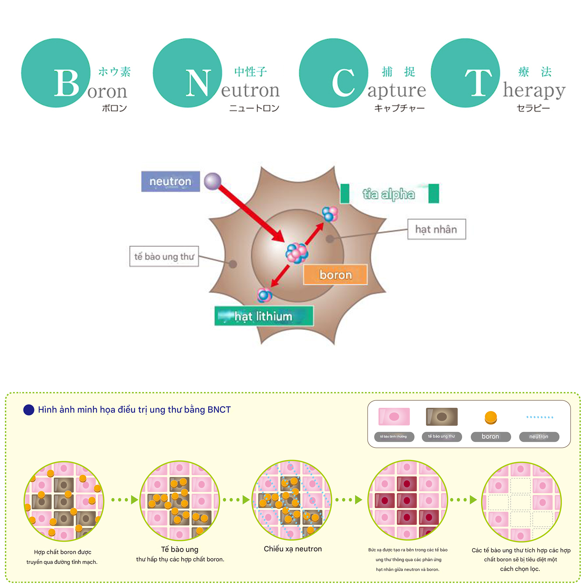 bnct-la-gi-phuong-phap-xa-tri-ung-thu-tien-tien-tu-nhat-ban