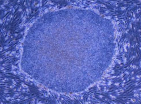 nhat-ban-phe-duyet-lieu-phap-te-bao-ips-dieu-tri-suy-tim-va-parkinson-buoc-ngoat-y-hoc-tai-tao-toan-cau